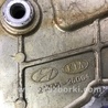 ФОТО Крышка ГРМ для Hyundai Sonata YF (09.2009-03.2014) Киев