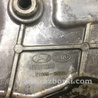 ФОТО Крышка ГРМ для KIA Forte TD (08-13) Киев